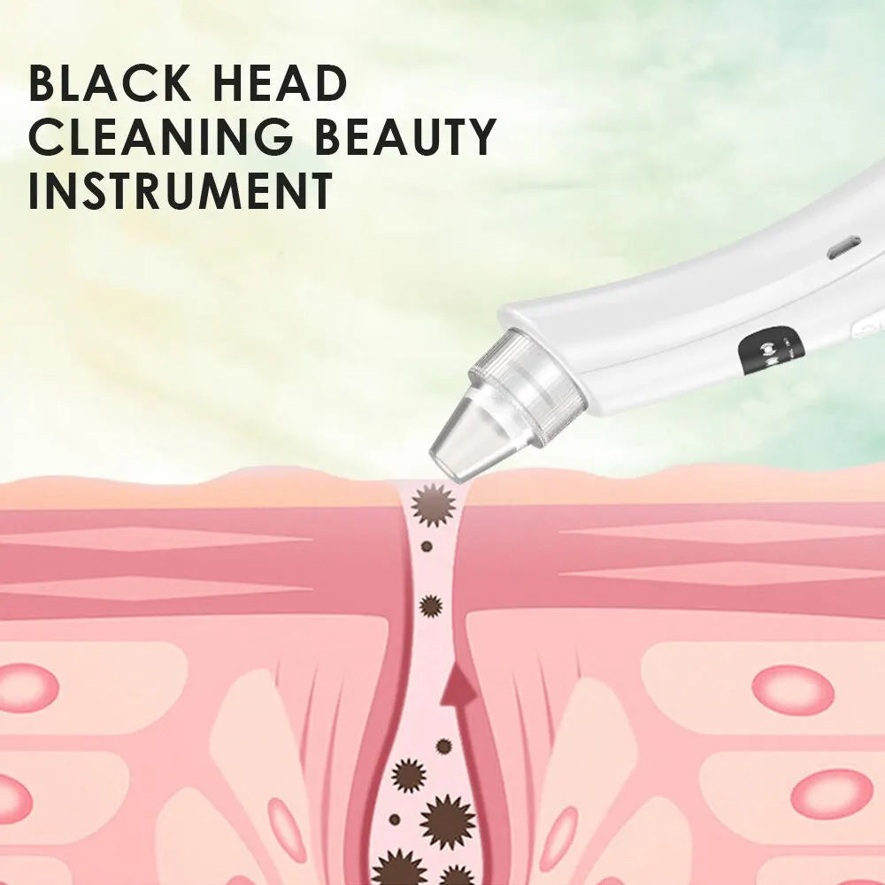 Veloura Deep Pore Cleansing Vacuum